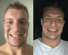 Load image into Gallery viewer, Snow Teeth Whitening™ At-Home System All-in-One Kit