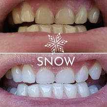 Load image into Gallery viewer, SISTEMA EM CASA SNOW TEETH WHITENING™ [‘KIT’ COMPLETO]
