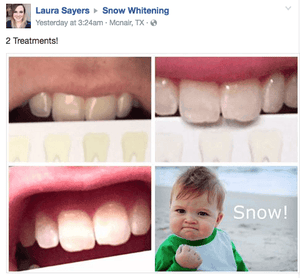 SISTEMA EM CASA SNOW TEETH WHITENING™ [‘KIT’ COMPLETO]