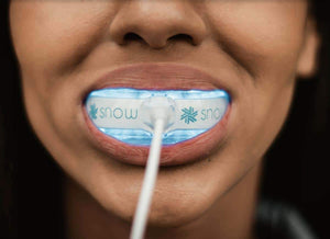 SNOW® SENSITIVE TEETH WHITENING AT-HOME SYSTEM [ALL-IN-ONE KIT]