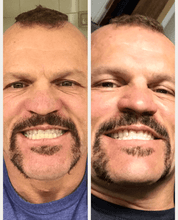 Load image into Gallery viewer, GRONK&#39;s Snow® Teeth Whitening At-Home System [All-in-One Kit]
