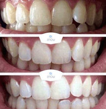 Load image into Gallery viewer, Special Offer - SNOW Teeth Whitening™ System
