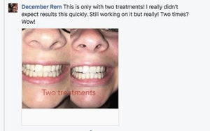 Special Offer - SNOW Teeth Whitening™ System